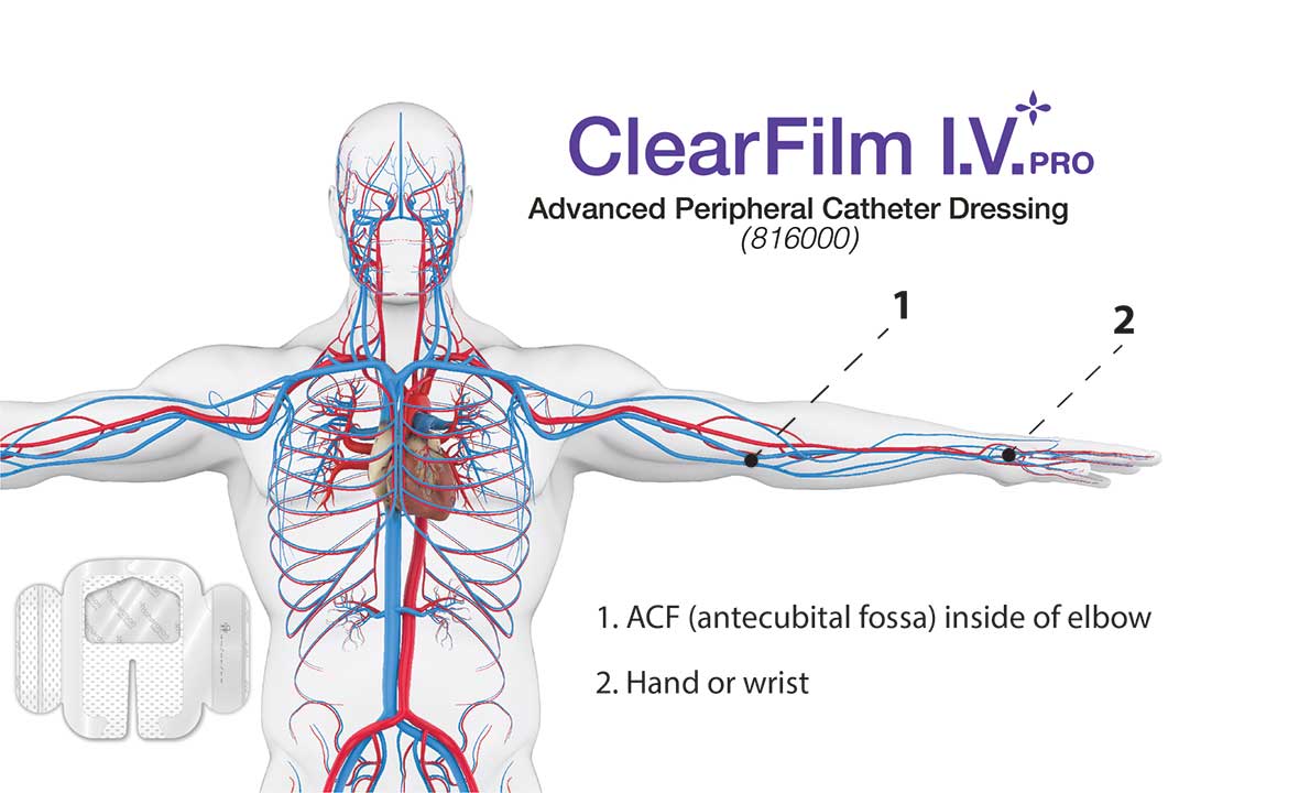 ClearFilm-IV-Pro - Advanced Peripheral Catheter Dressing