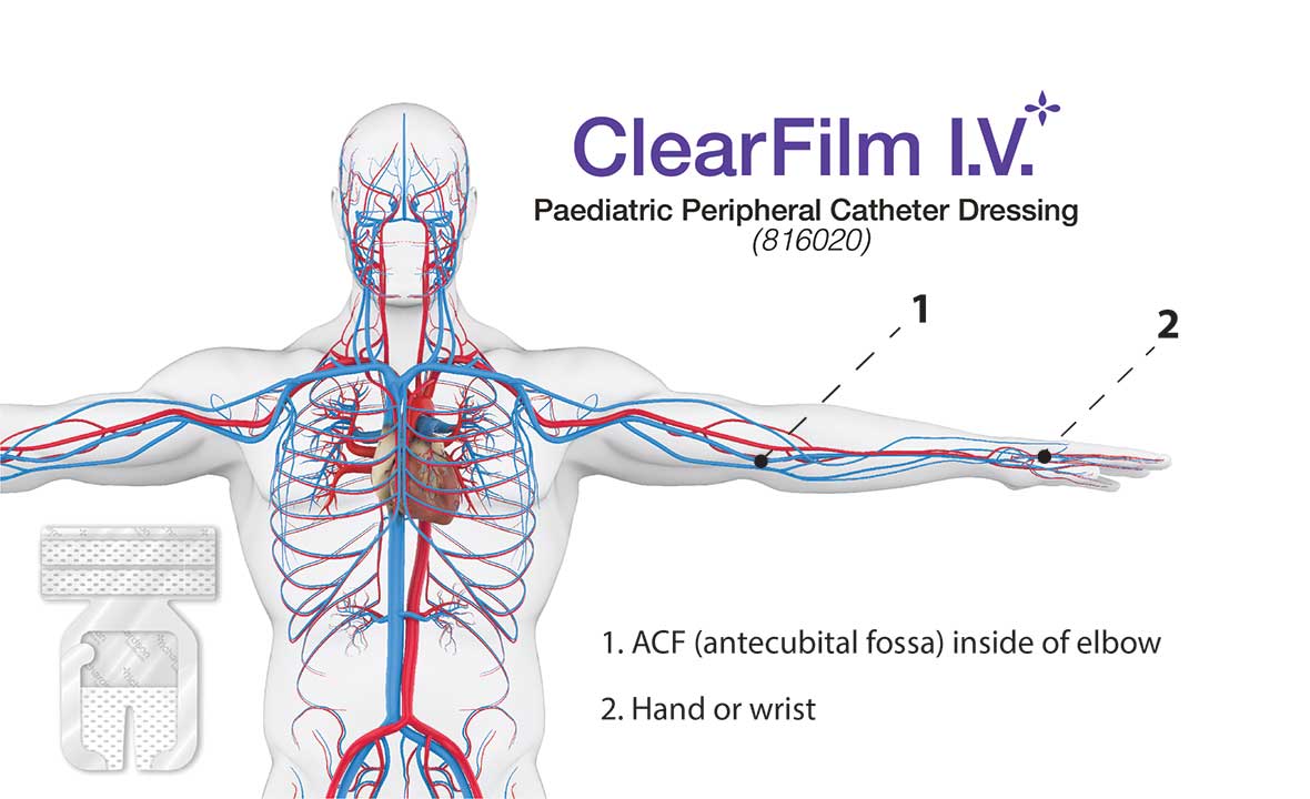 ClearFilm-IV - Paediatric Peripheral Catheter Dressing