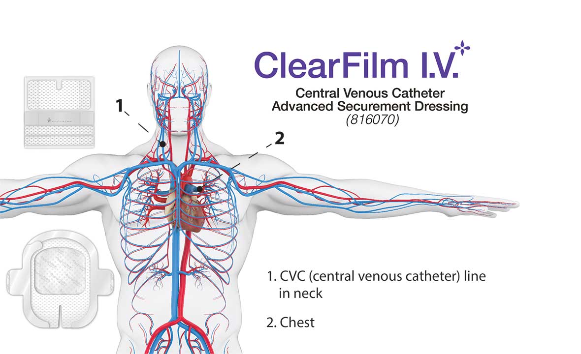 ClearFilm-IV-Pro - CVC Advanced Securement Dressing