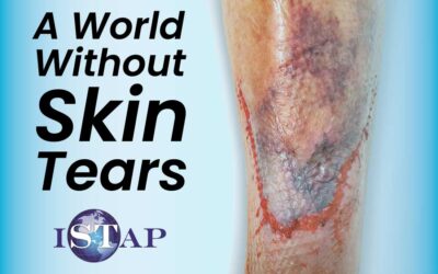 A World Without Skin Tears Day: Second Annual Event