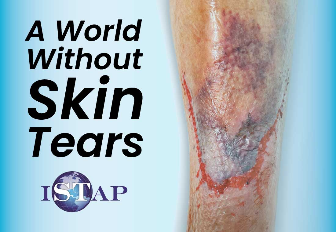a world without skin tears