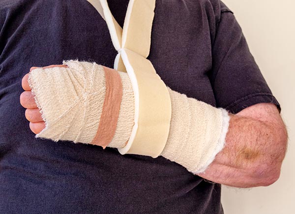 medicrepe-supports-broken-arm-min Medicrepe