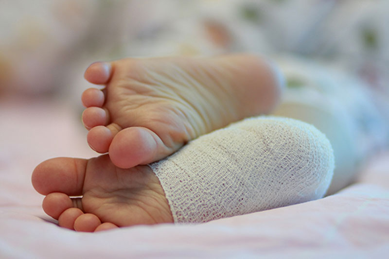 ortholite-bandage-on-child-leg-min Ortholite